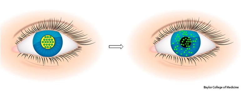 Dissolving contact lenses