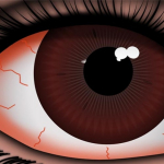 Illustration of a red eye