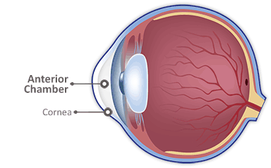 Anterior Chamber