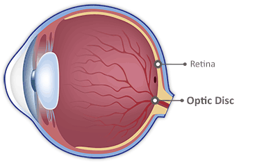 Optic Disc