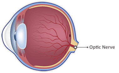 Optic Nerve