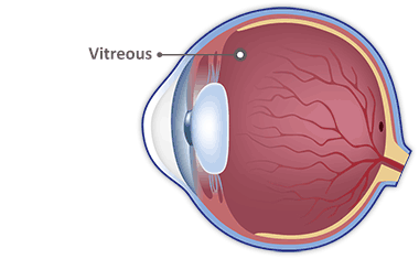 Vitreous